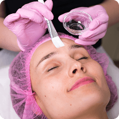 Chemical Peels