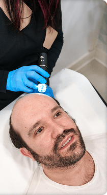 Hair Loss